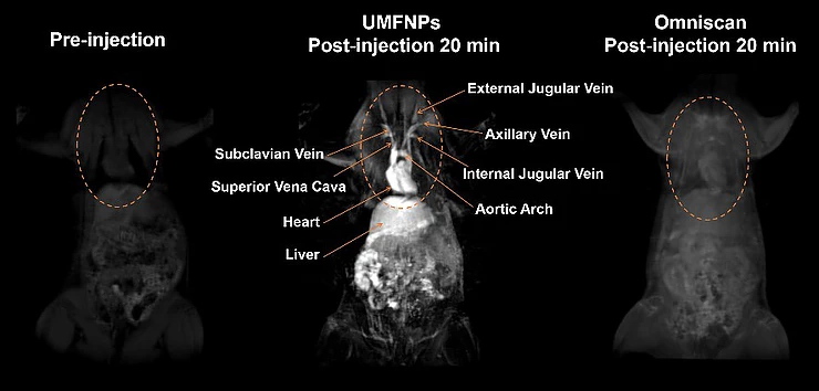 Ultrasmall Ferrite Nanoparticles T1 Contrast Agent: High-Performance T1 Magnetic Resonance Imaging of